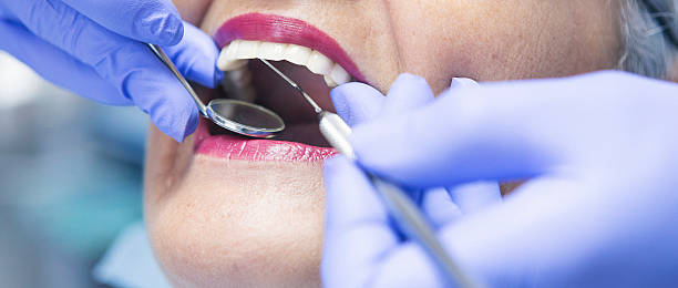 Best Chipped Tooth Repair Near Me  in Laware City, DE